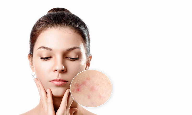 Dry Skincare Products: Guide to Hydrating and Nourishing Your Skin